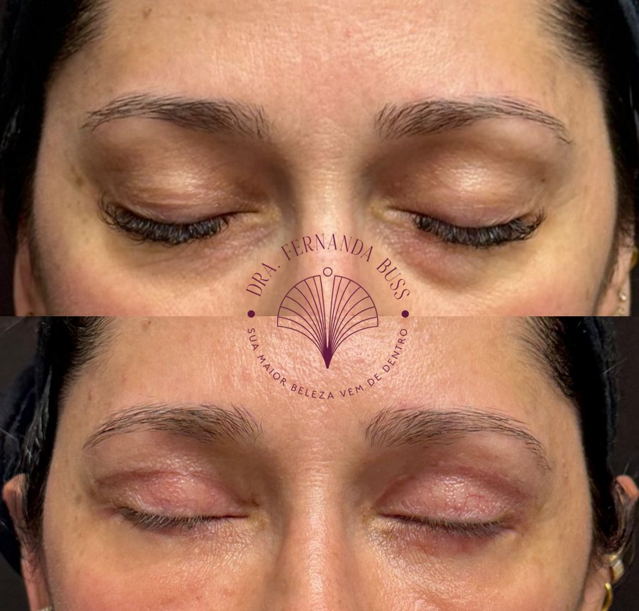 Caso 1, detalhe com os olhos fechados